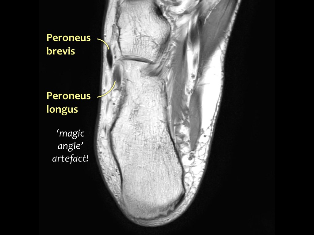 Slide 37