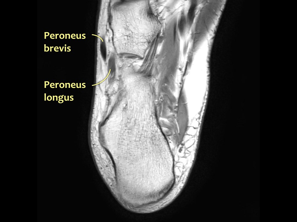 Slide 38