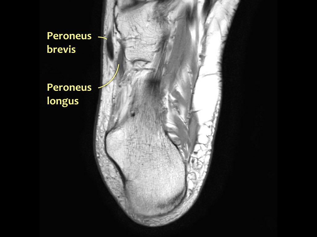 Slide 39