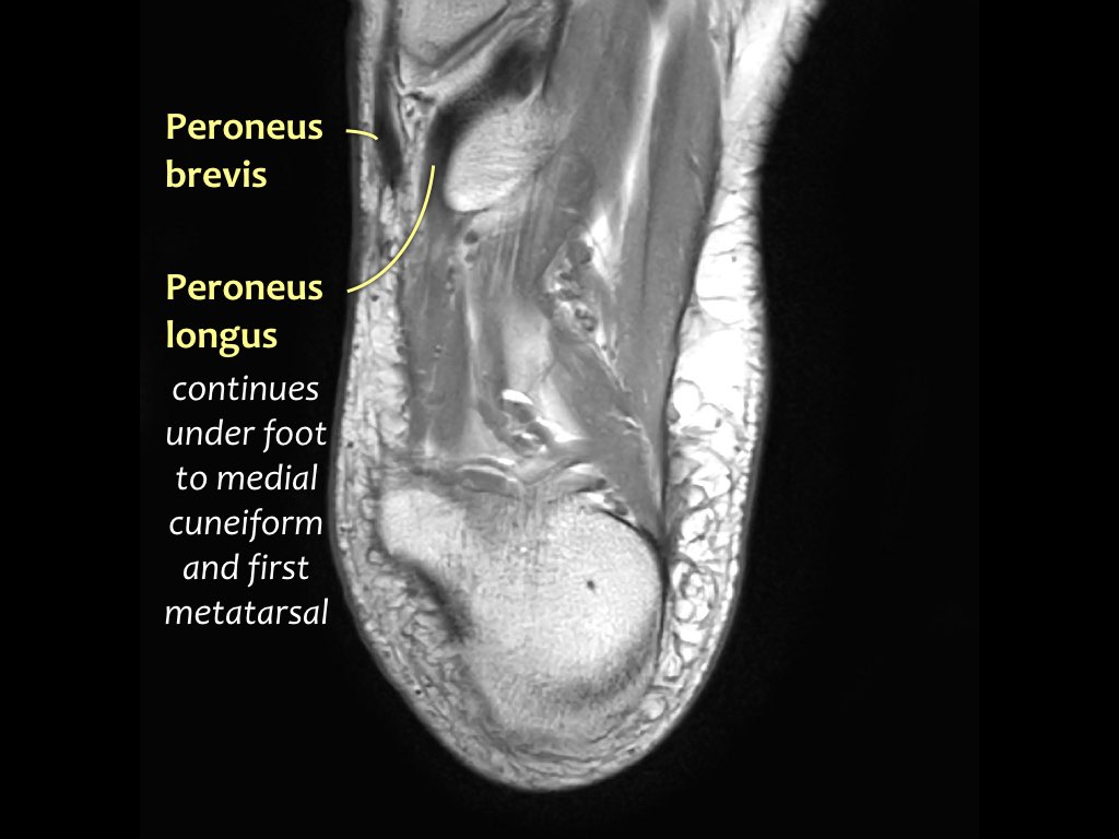 Slide 41