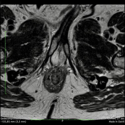 Slide 39