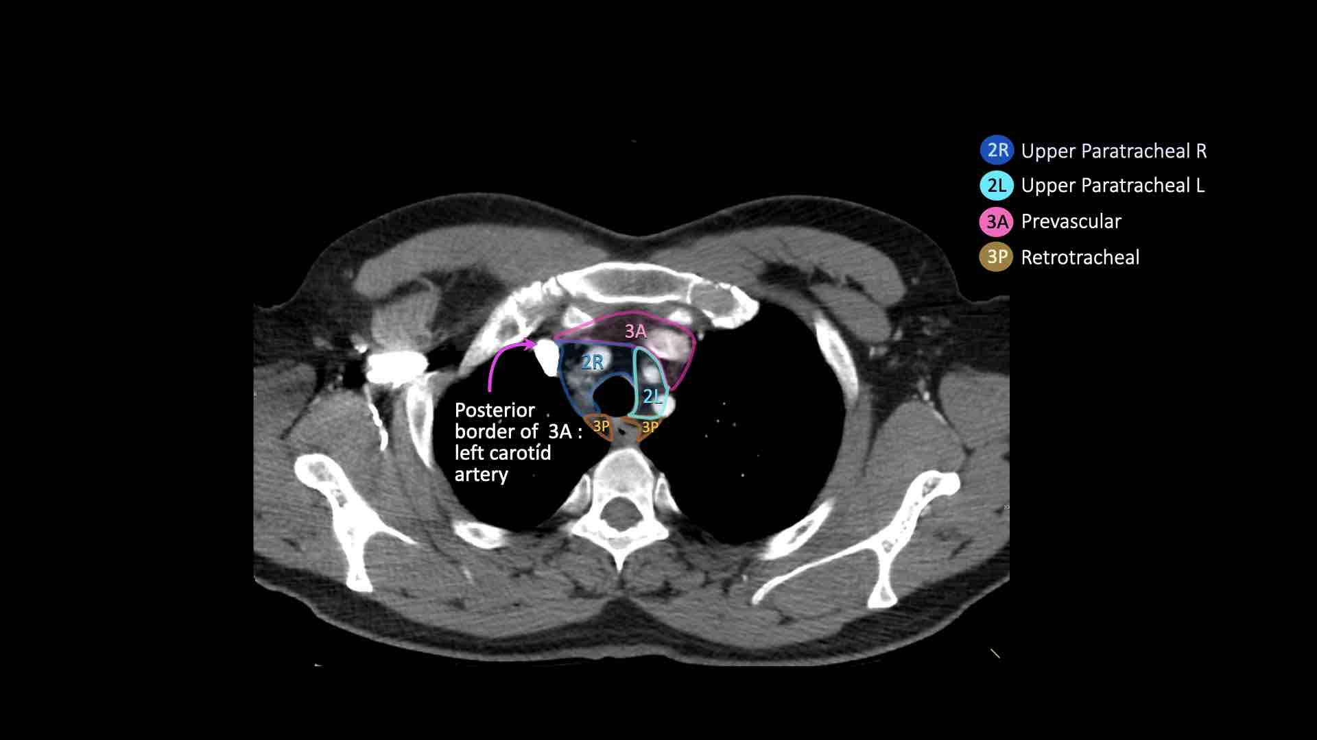Slide 11