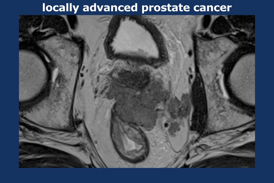 Slide 14