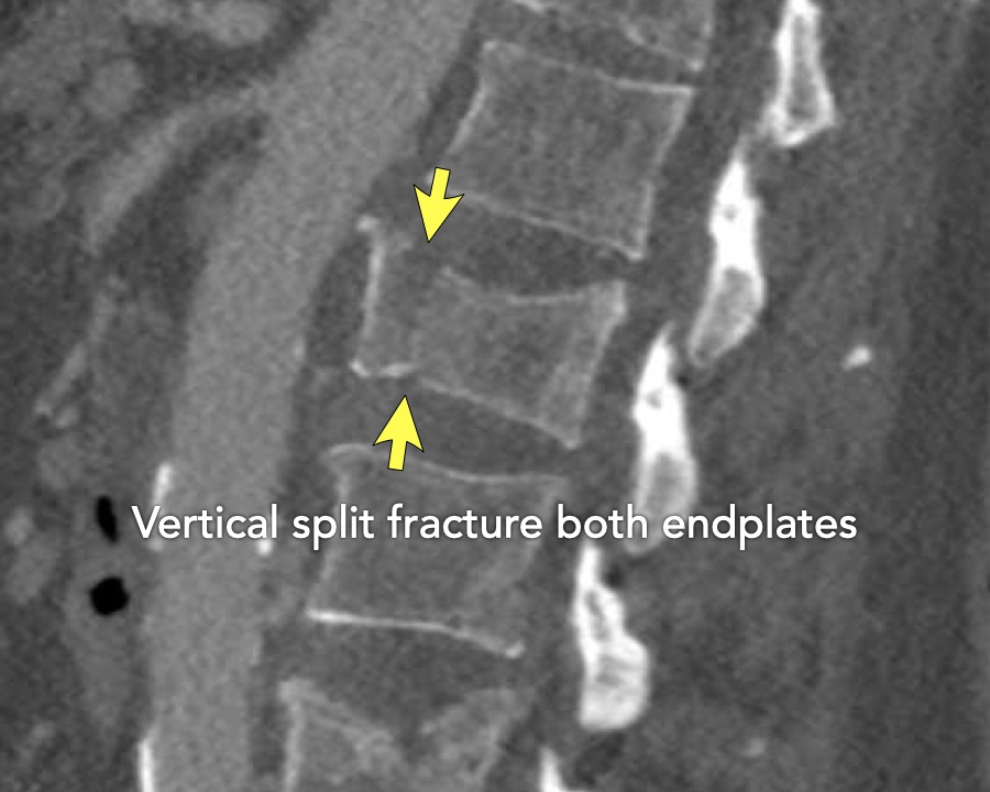 Slide 5