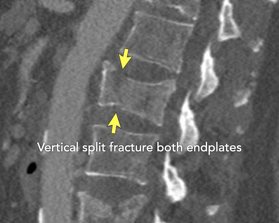 Slide 6