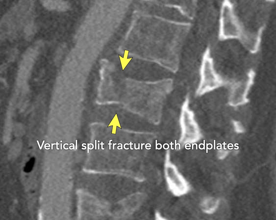 Slide 7
