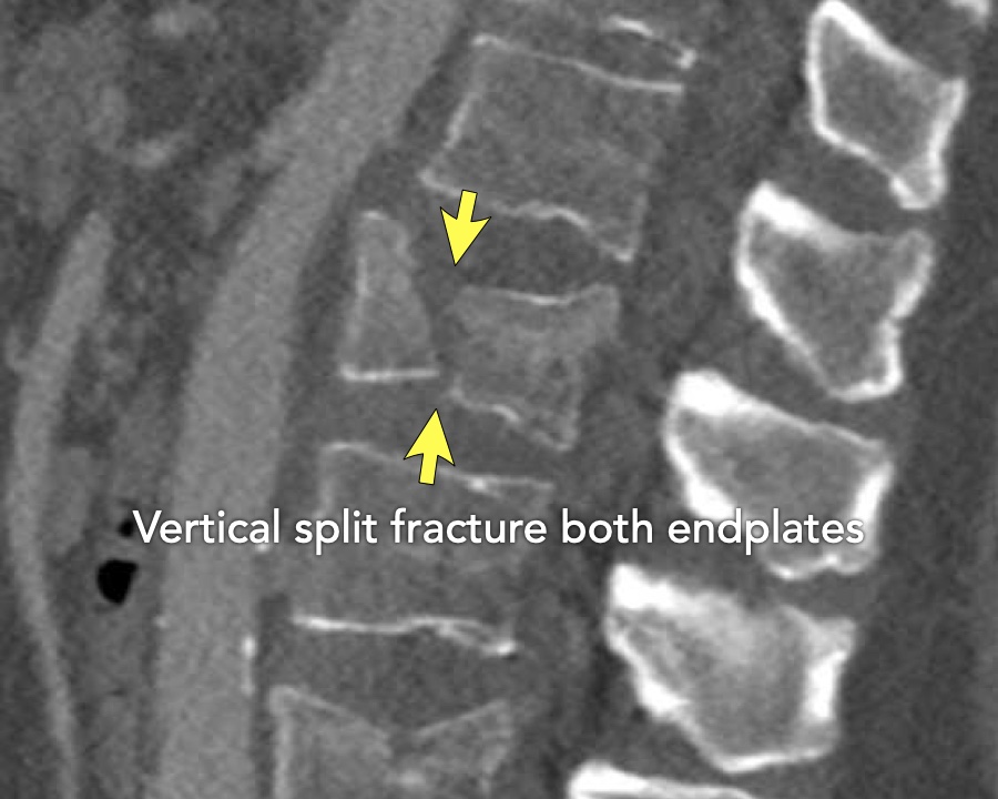 Slide 9
