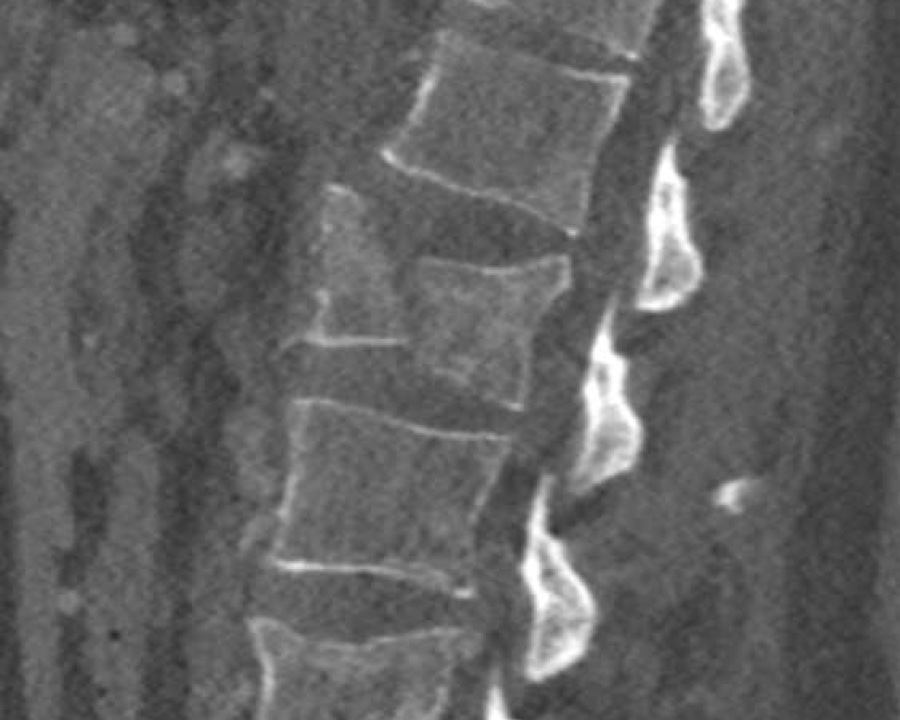 Slide 14