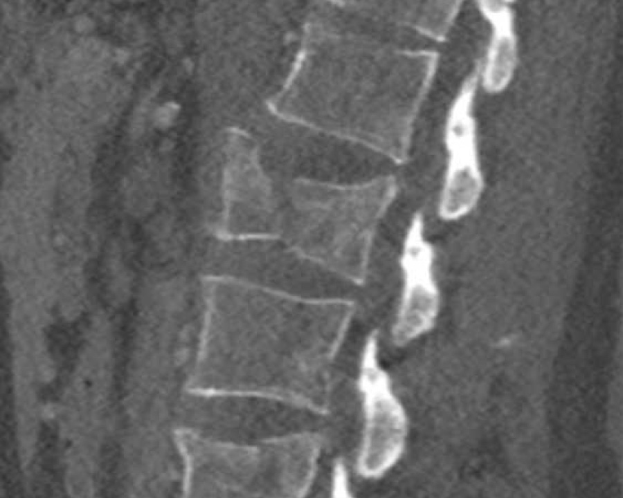 Slide 15