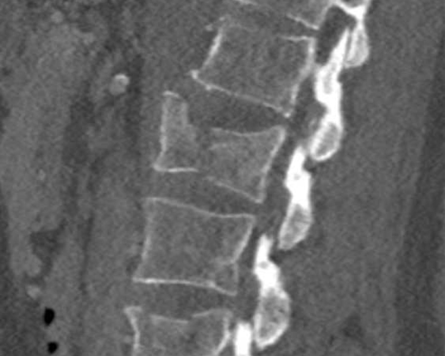 Slide 16