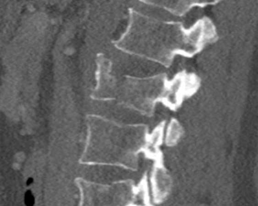 Slide 18