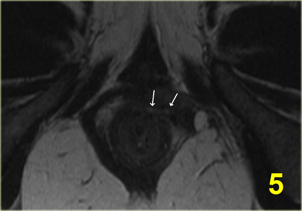 Slide 5