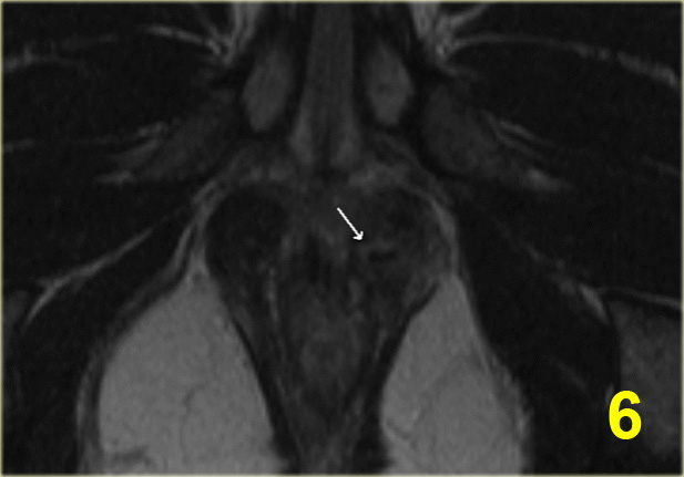 Slide 6