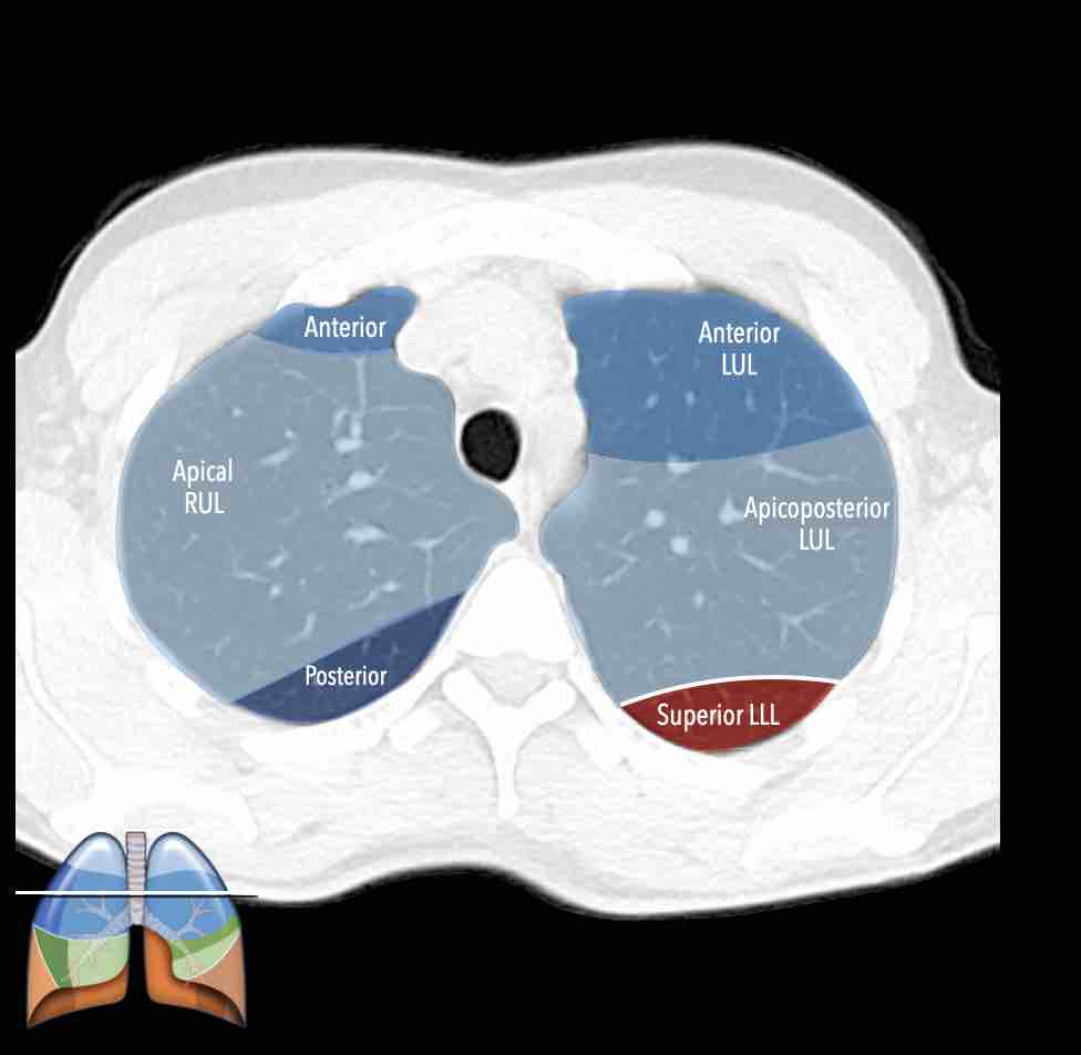 Slide 6