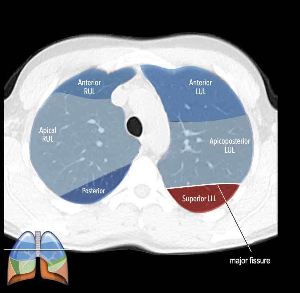 Slide 7