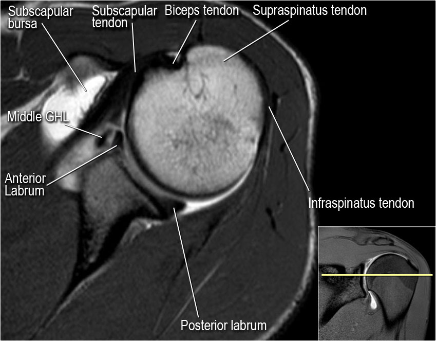 Slide 6